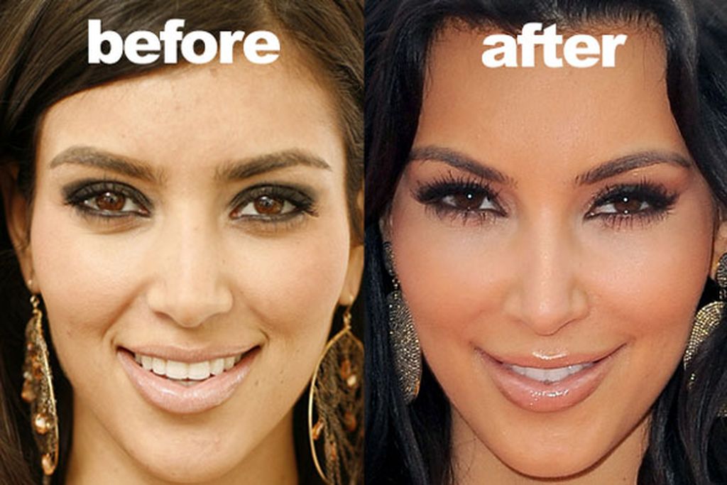 Kim Kardashian's Nose Job, Eyebrows And Nails