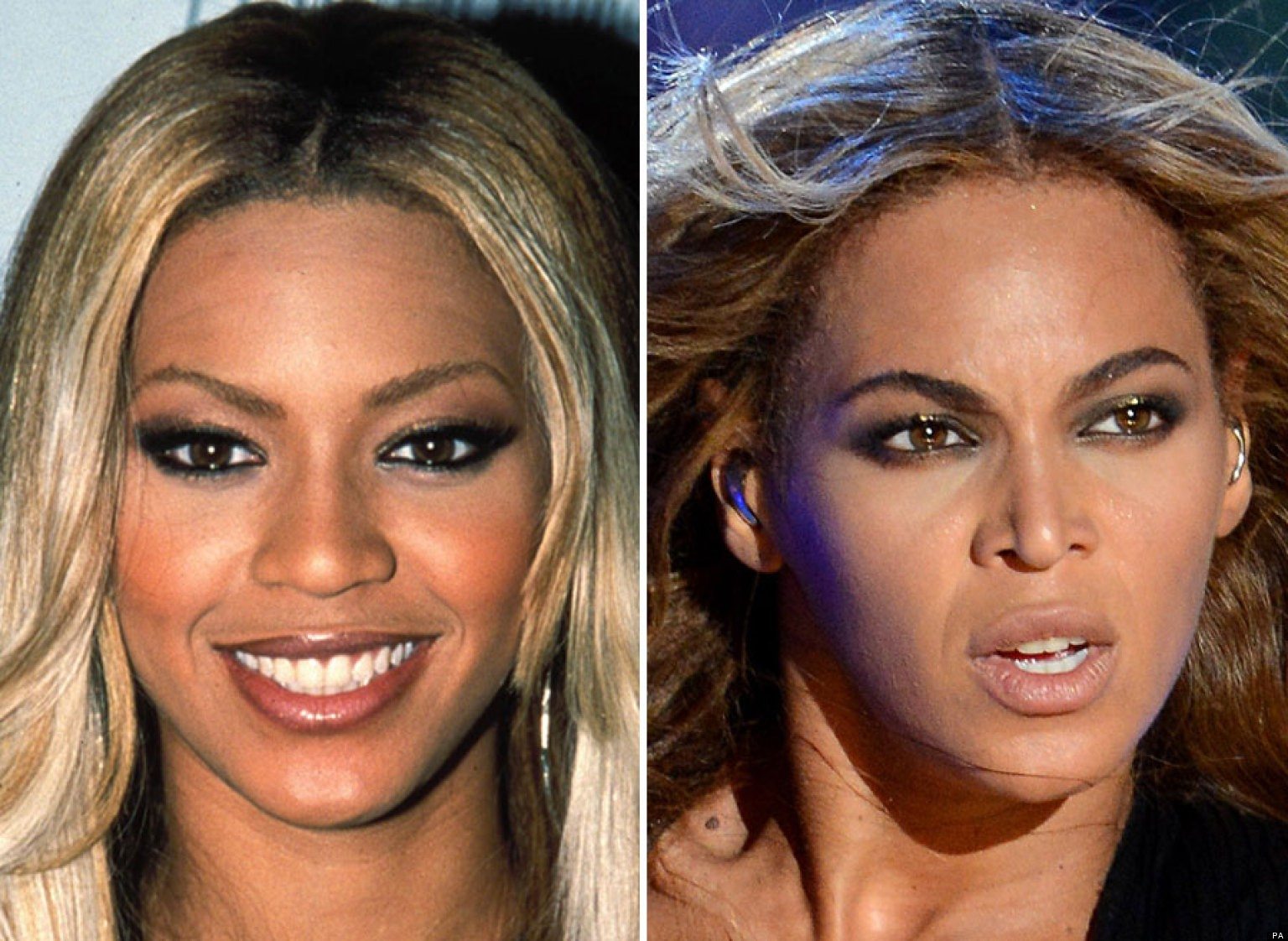 Beyonce Plastic Surgery, Nose Job