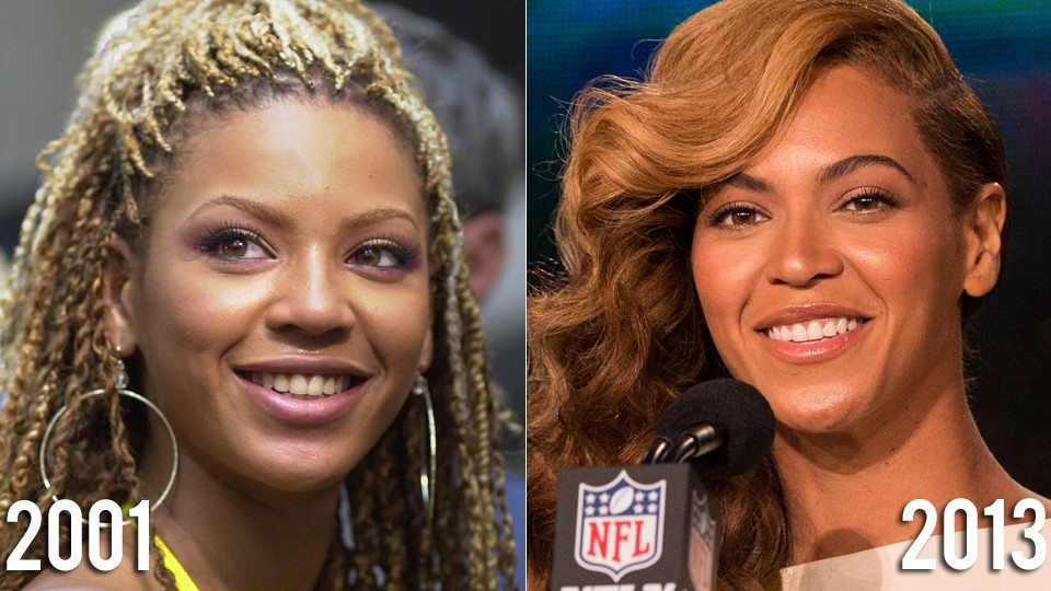 Here’s Why People Think Beyonce Has Had a Nose Job.