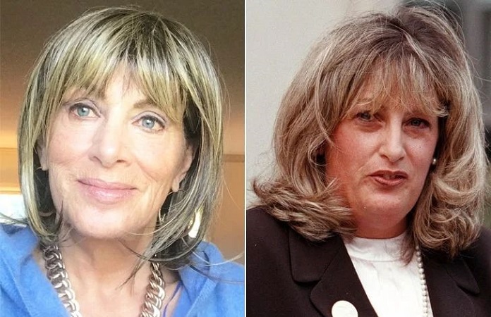 Linda Tripp's Plastic Surgery