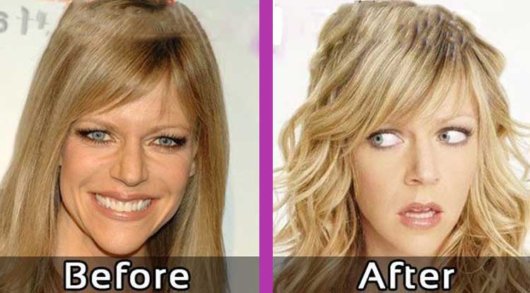 Did Kaitlin Olson Do Plastic Surgery? Her Looks Before and After Photos