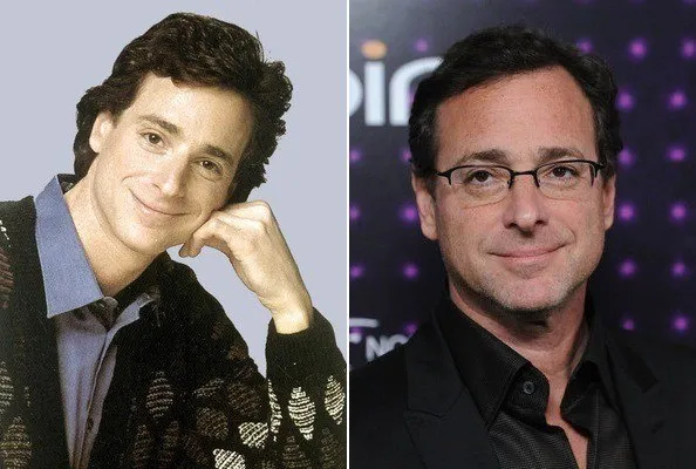 Bob Saget Face Surgery