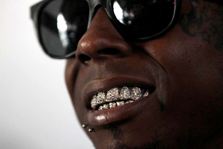 Lil Wayne's Teeth, Dreads, Baby Mamas And Girlfriend