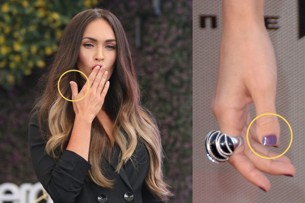 What Happened To Megan Fox’s Thumbs? Here