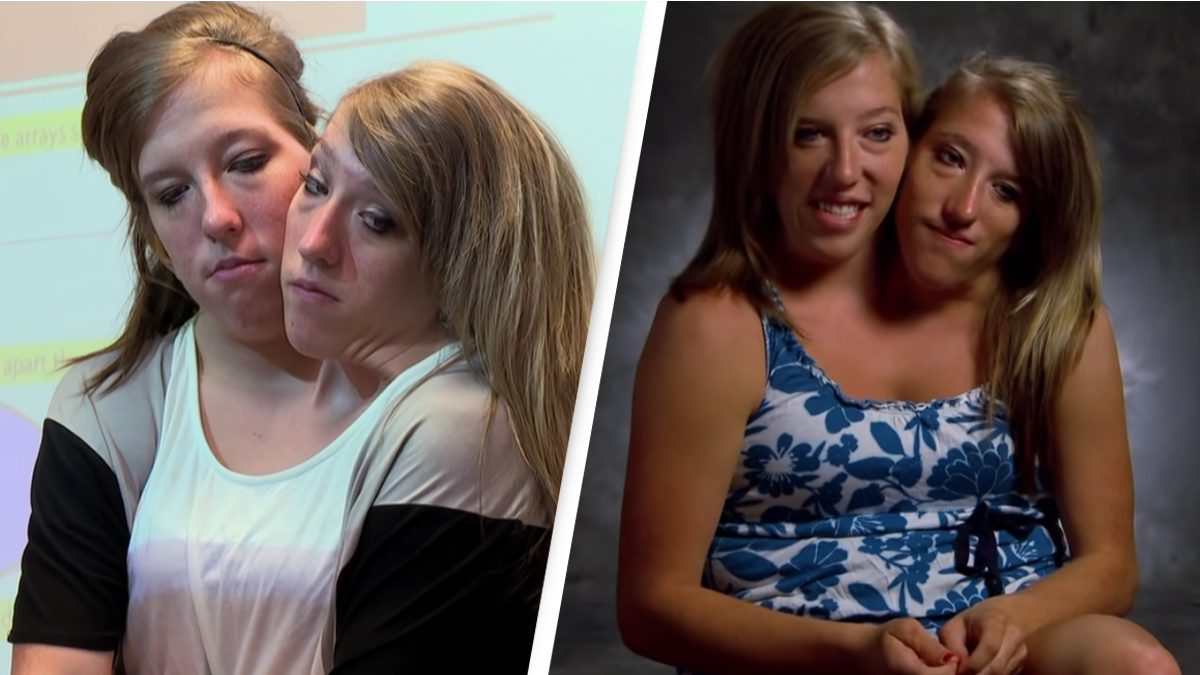 Conjoined twins Abby and Brittany Hensel from Minnesota set to become  reality TV stars - Mirror Online